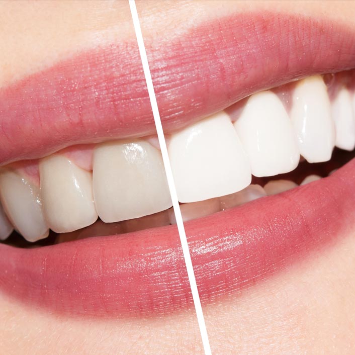 COSMETIC DENTISTRY